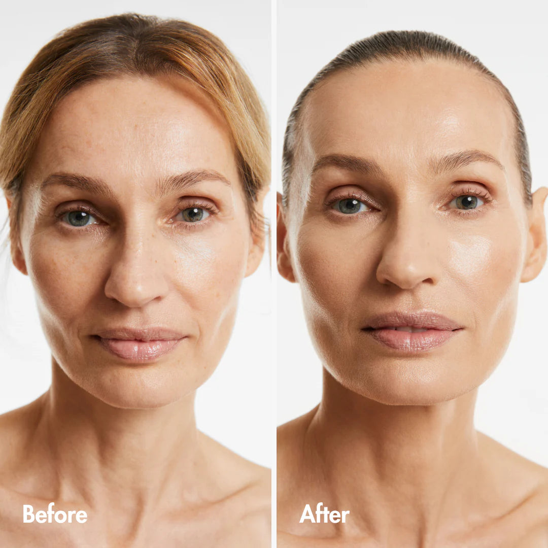 Skin Rejuvenation