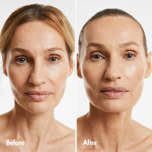 Skin Rejuvenation