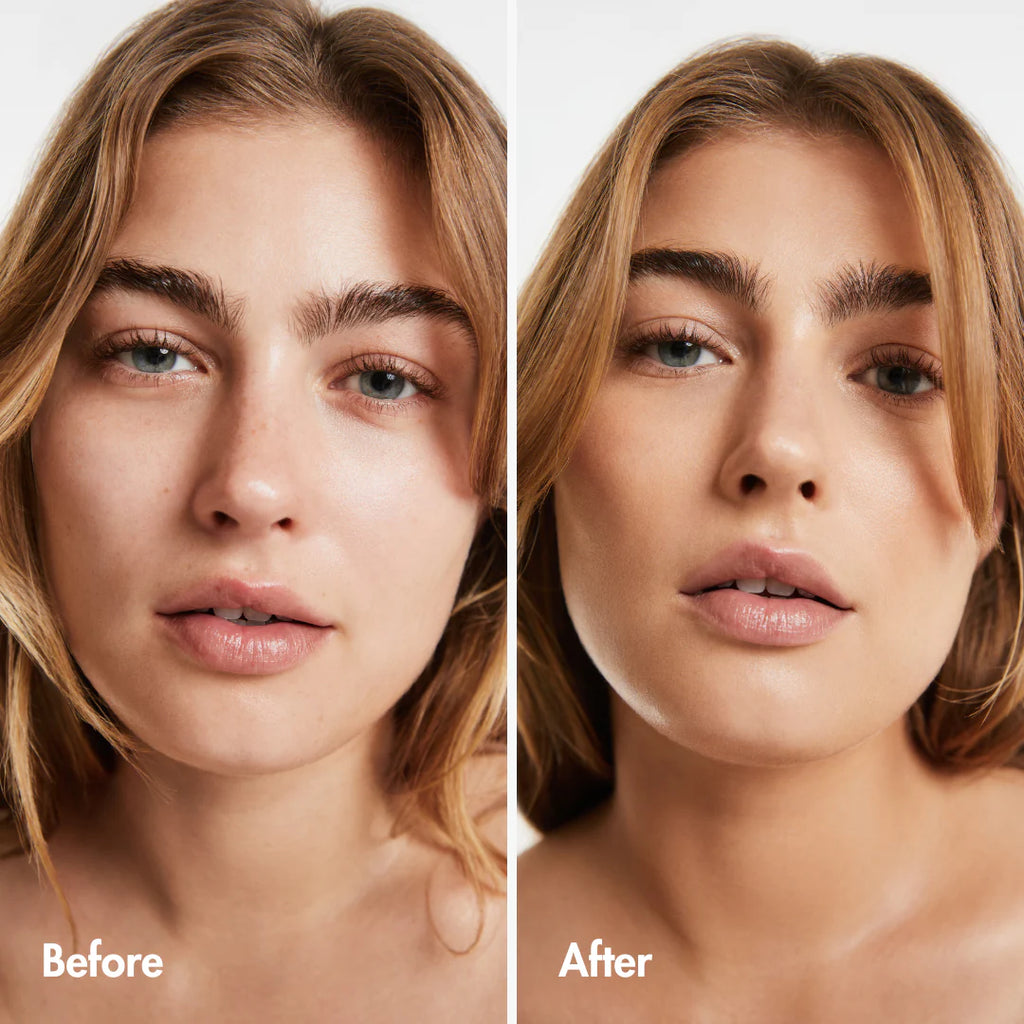 Skin Rejuvenation